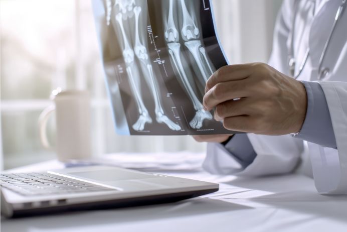 Medical professional reviewing an x-ray.